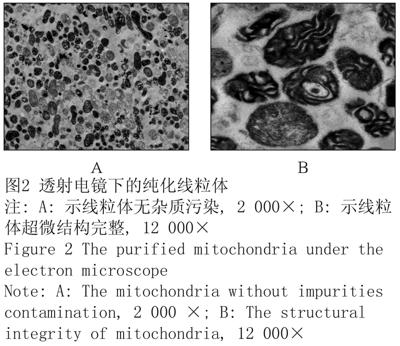 图2 透射电镜下的纯化线粒体 figure 2 the purified