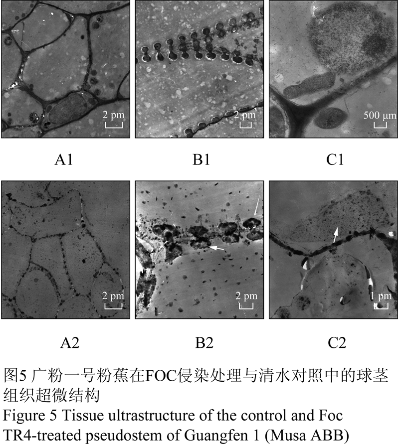 抗感枯萎病香蕉的细胞结构抗性研究