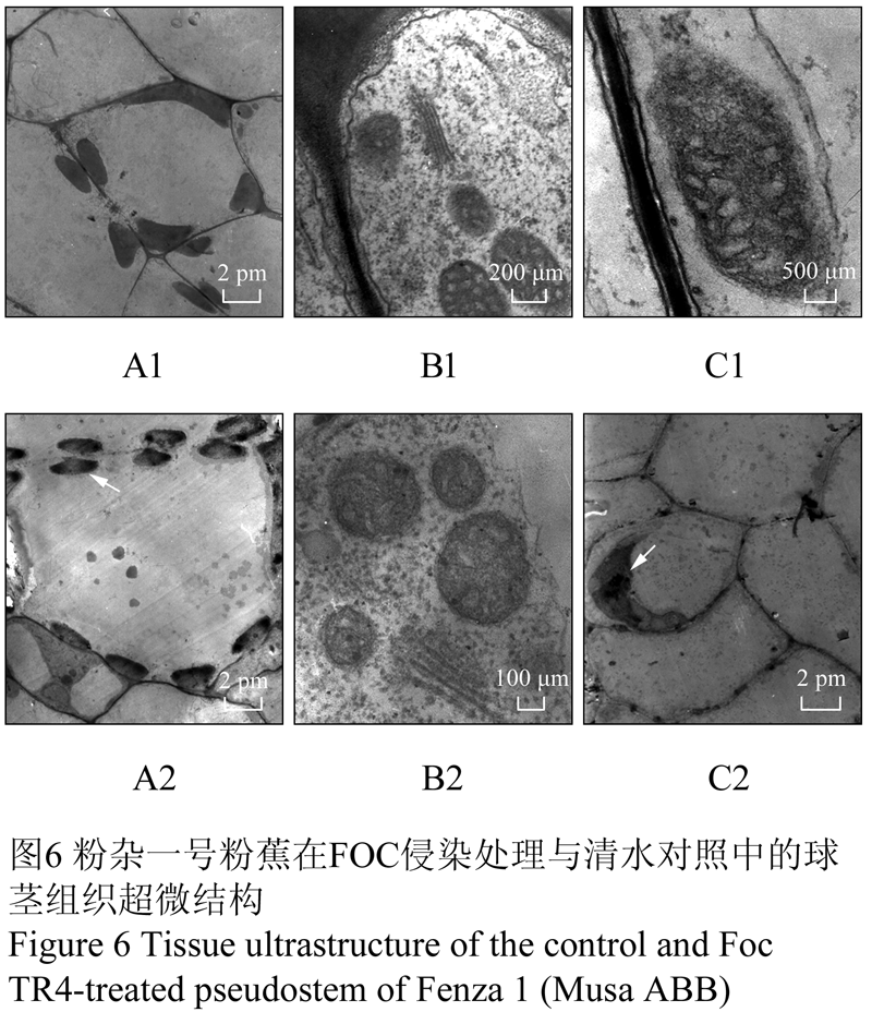 抗感枯萎病香蕉的细胞结构抗性研究